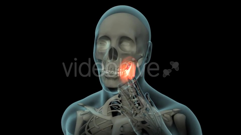 Toothache Videohive 21271027 Motion Graphics Image 5