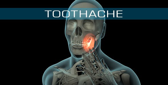 Toothache - Download Videohive 21271027