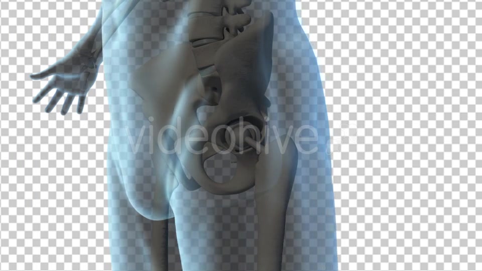 Total Hip Replacement Videohive 19511345 Motion Graphics Image 8