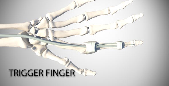 Trigger Finger - 16082163 Download Videohive