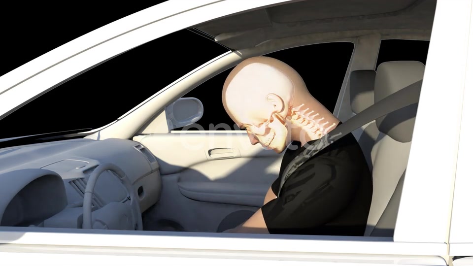 Whiplash In Car Accident Videohive 22678886 Motion Graphics Image 4