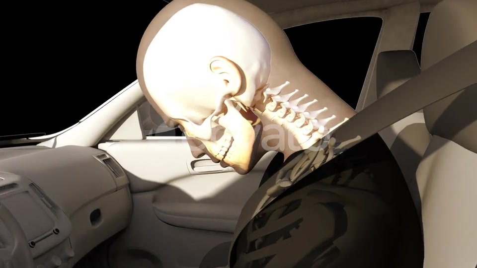 Whiplash In Car Accident Videohive 22678886 Motion Graphics Image 5