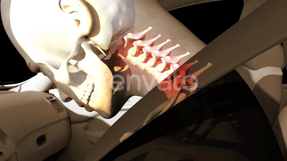Whiplash In Car Accident Videohive 22678886 Motion Graphics Image 6