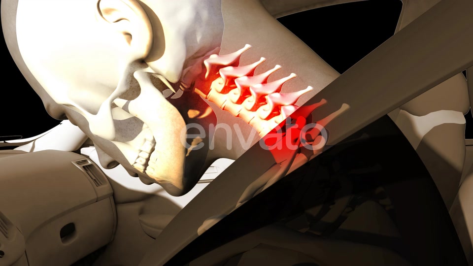 Whiplash In Car Accident Videohive 22678886 Motion Graphics Image 7