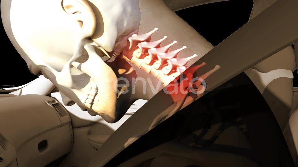 Whiplash In Car Accident Videohive 22678886 Motion Graphics Image 8
