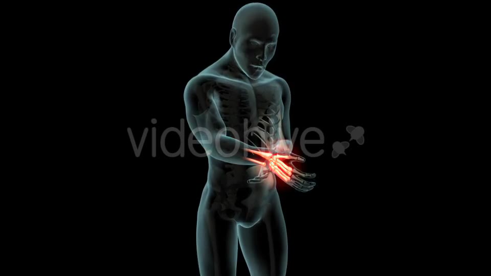 Wrist Pain Videohive 21281895 Motion Graphics Image 2