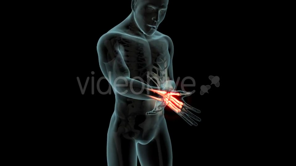 Wrist Pain Videohive 21281895 Motion Graphics Image 3