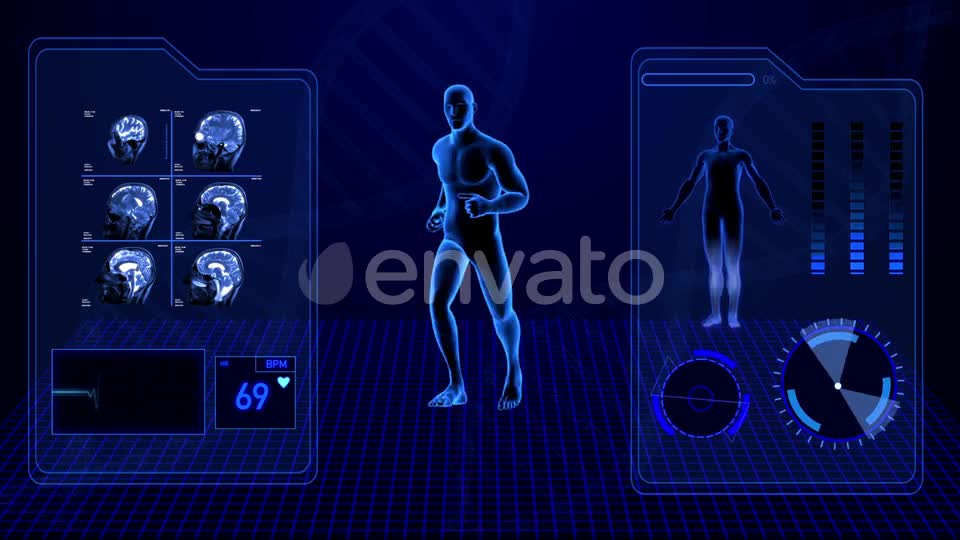 X Ray Radiology Scan of Human Body and Brain Health Data Infographic Videohive 25047951 Motion Graphics Image 1
