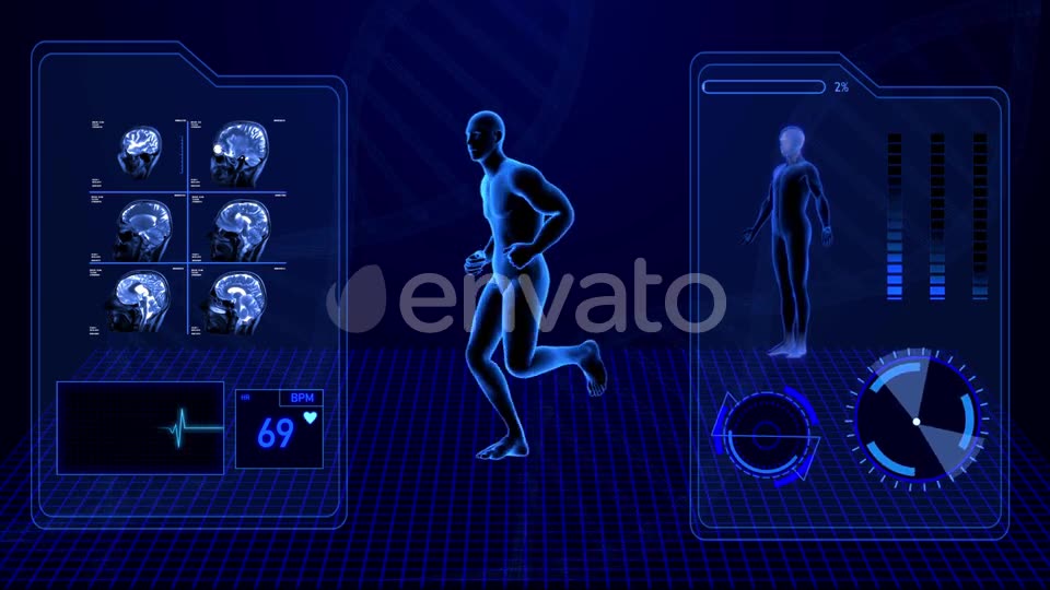 X Ray Radiology Scan of Human Body and Brain Health Data Infographic Videohive 25047951 Motion Graphics Image 2