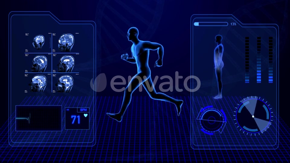 X Ray Radiology Scan of Human Body and Brain Health Data Infographic Videohive 25047951 Motion Graphics Image 3