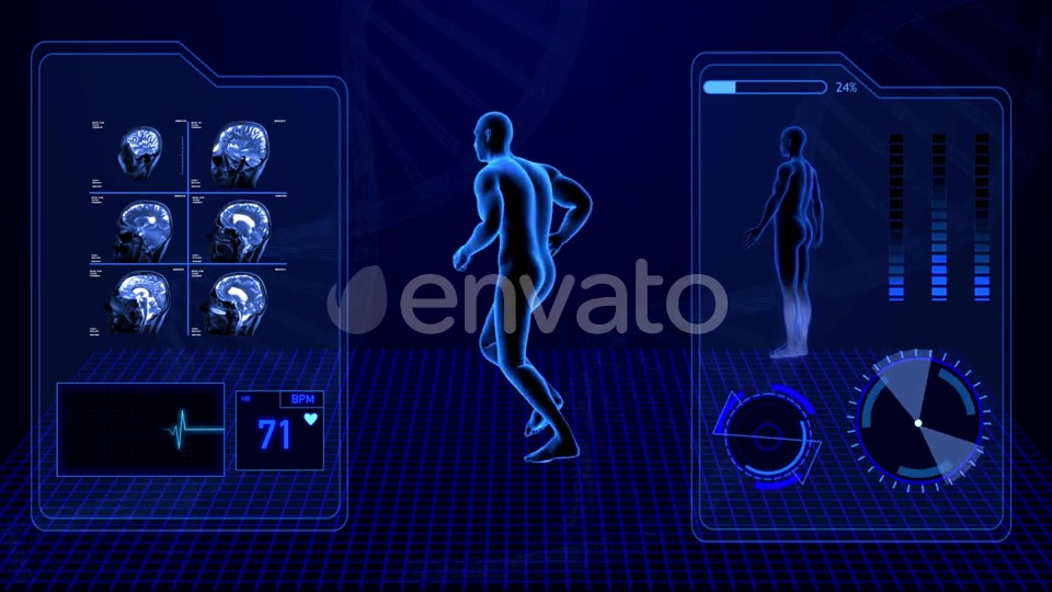 X Ray Radiology Scan of Human Body and Brain Health Data Infographic Videohive 25047951 Motion Graphics Image 4