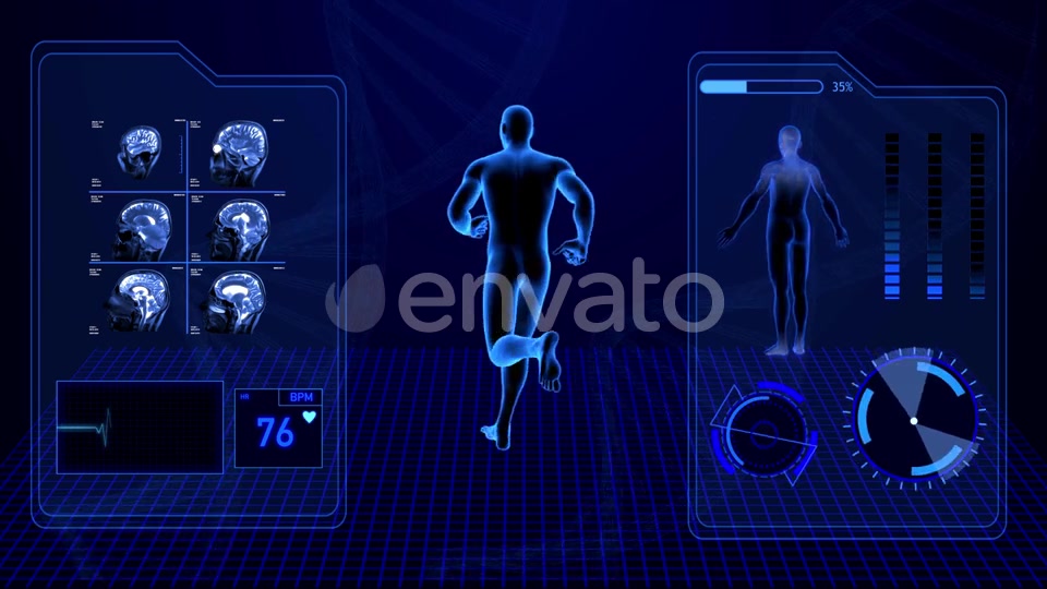 X Ray Radiology Scan of Human Body and Brain Health Data Infographic Videohive 25047951 Motion Graphics Image 5