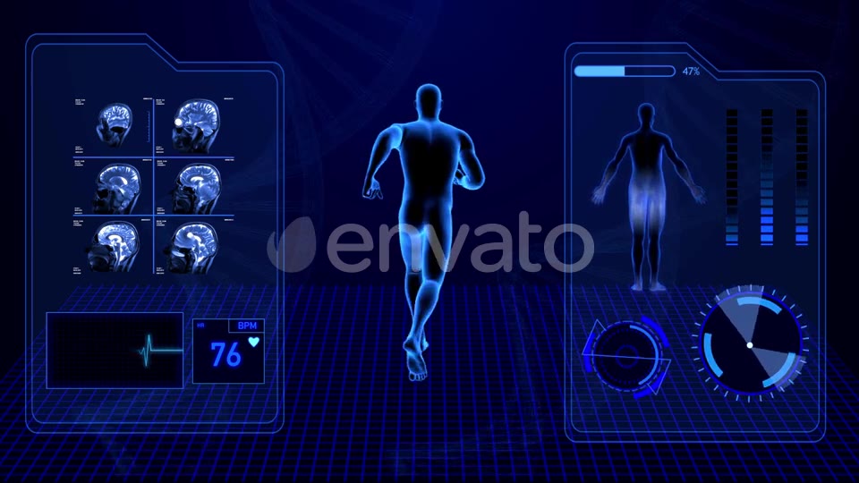 X Ray Radiology Scan of Human Body and Brain Health Data Infographic Videohive 25047951 Motion Graphics Image 6