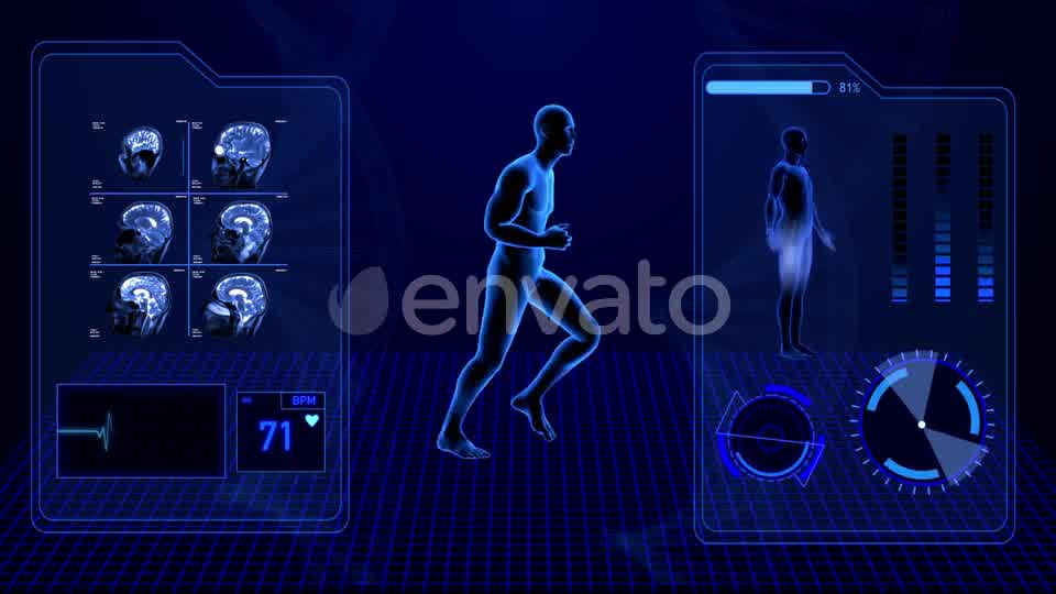 X Ray Radiology Scan of Human Body and Brain Health Data Infographic Videohive 25047951 Motion Graphics Image 9