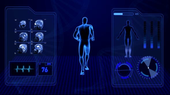 X Ray Radiology Scan of Human Body and Brain Health Data Infographic - Videohive Download 25047951
